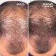 Freshly Cosmetics - Sérum De Crecimiento Capilar Hair Growth, estudios eficacia 96% usuarios satisfechos, frenar caída capilar, Saw Palmetto. También para Dermaroller 50ml - 5