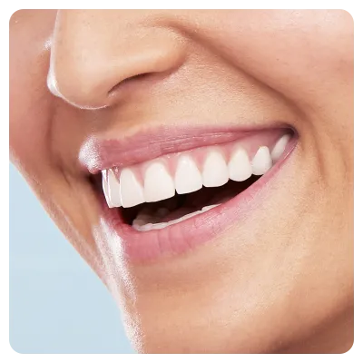 Oral-B Vitality 100 CrossAction cepillo de dientes eléctrico Blanco - 3