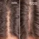 Freshly Cosmetics - Sérum De Crecimiento Capilar Hair Growth, estudios eficacia 96% usuarios satisfechos, frenar caída capilar, Saw Palmetto. También para Dermaroller 50ml - 3